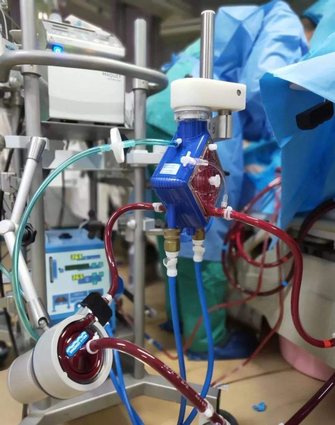 高压吸氧多少钱一次(重症肺炎最后都要用人工肺吗) - 价格百科