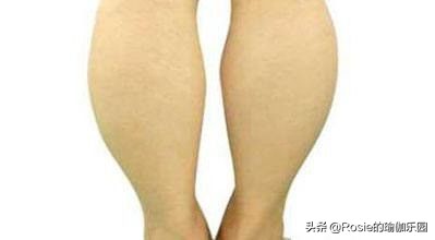萝卜腿不敢穿小黑裙？最全瘦小腿套餐，一周拯救小腿粗恣意穿