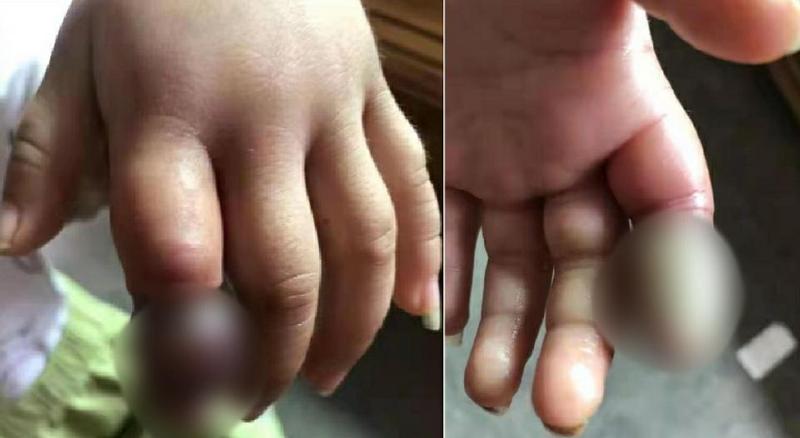 皮筋手绳编织方法教程（截指警告）