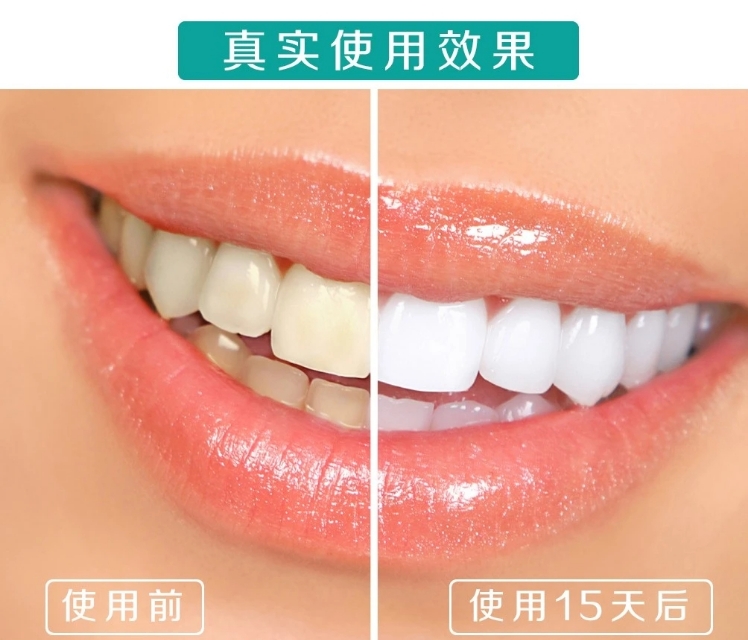 林狗让你用漱口水