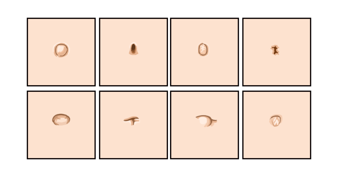 肚脐眼长得难看,难道是医生手艺不好?这次真的"躺枪了"