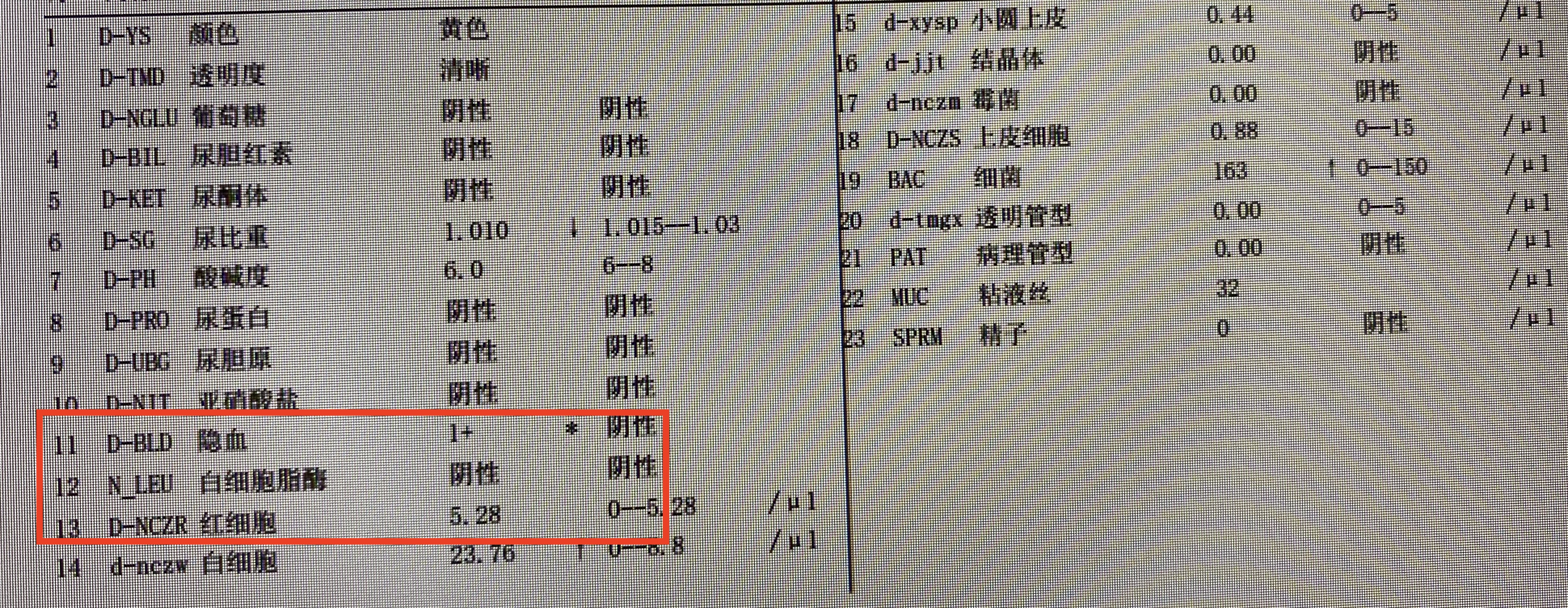 尿检红细胞多少算严重(尿隐血3) - 青木春
