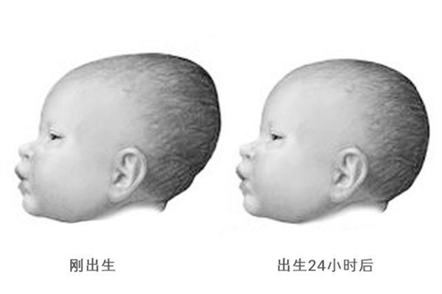 囟门闭合的时间，与宝宝的大脑发育有关，尤其有三种情况要重视