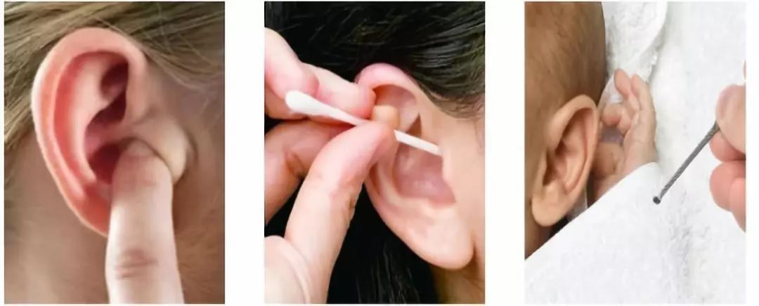 小米众筹掏耳勺火了,把传统非遗采耳带到家里,掏得干净还能挤痘