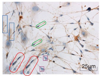 海南医学院第一附属医院发表的SCI因图片疑似重复被质疑
