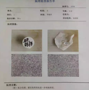 21岁女大学生确诊胃癌！父亲一句哭诉，道出悲剧的原因