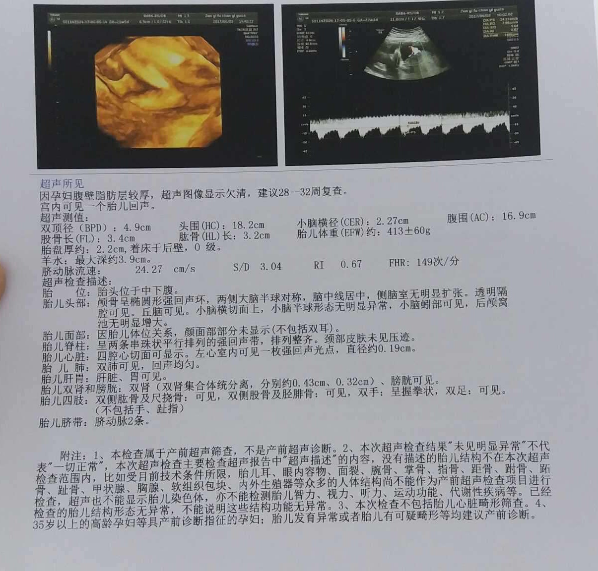 羊水指数四个值解读：孕期四维检查中AFI测量标准与临床意义分析