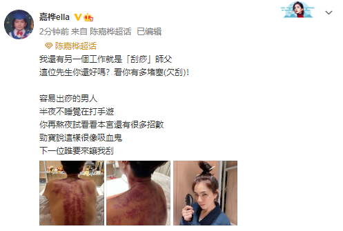 Ella晒与老公相爱相杀日常，怒批老公熬夜打游戏后，贴心帮其刮痧