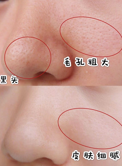 这款被称作“神奇”的泥膜，得到张韶涵力荐：草莓鼻用几次就好了