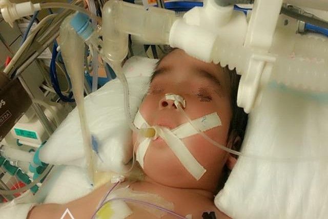 4岁娃铅中毒,智力再难发育,家长要小心潜伏在娃身边的"隐患"