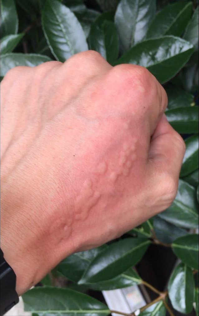 童年噩梦洋辣子,虽然长得丑还有毒,依然躲不过200一斤上餐桌