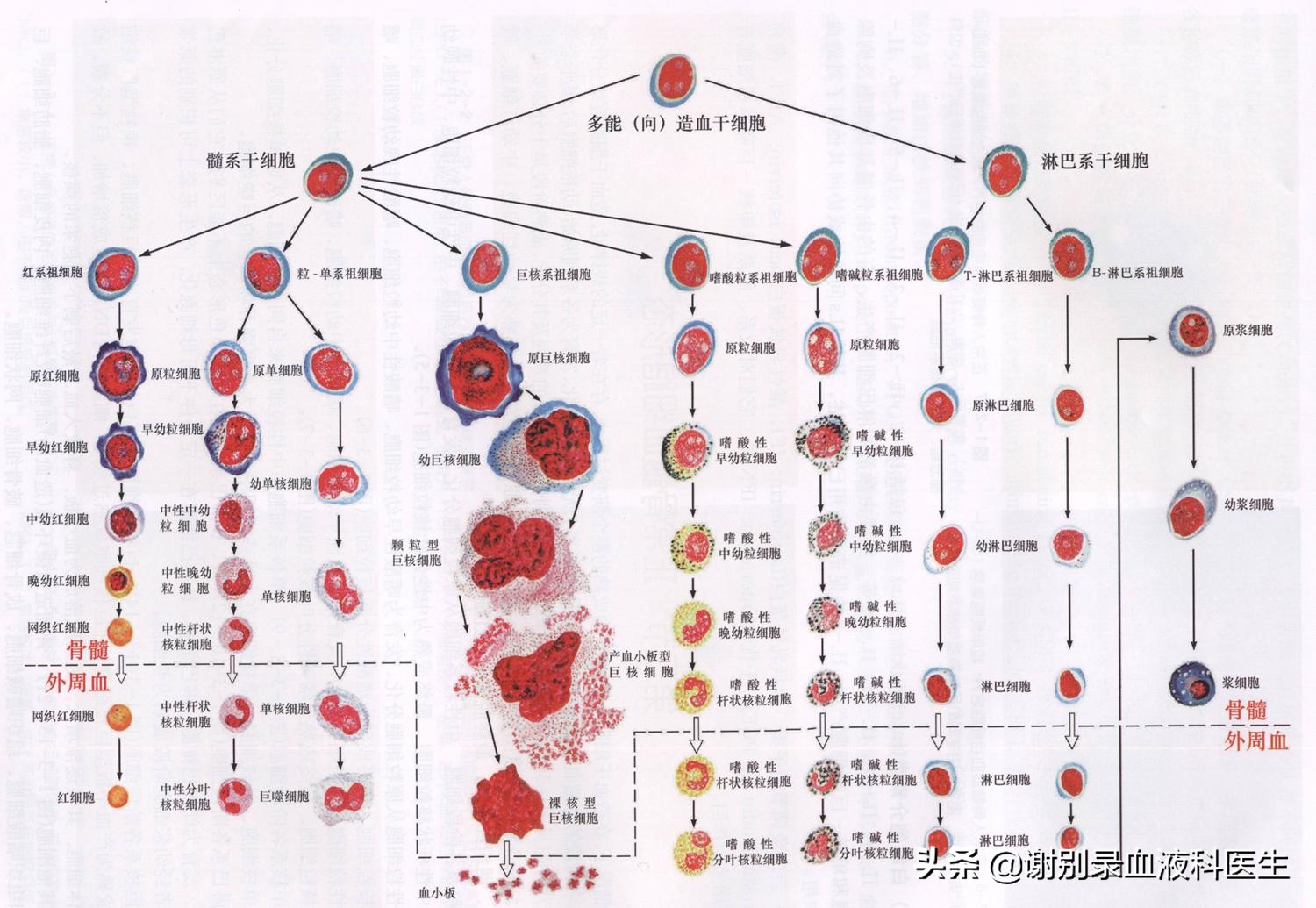 血小板增高能治愈吗？