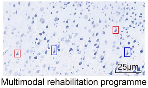 海南医学院第一附属医院发表的SCI因图片疑似重复被质疑