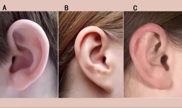 哪种耳朵有福气图片图片
