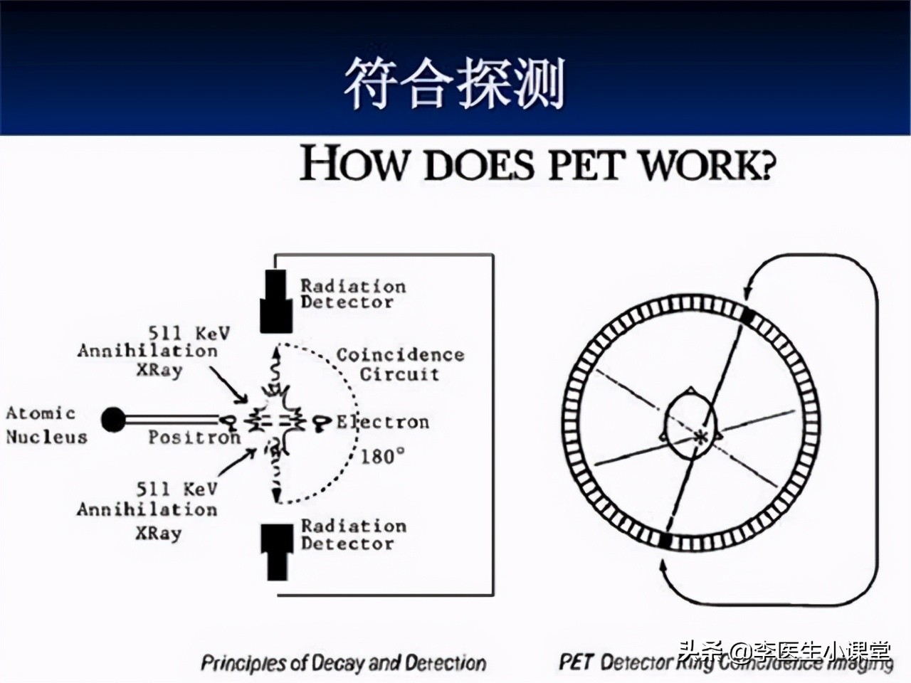 1万一次的PET-CT是什么？值得做吗？专家为你揭晓答案