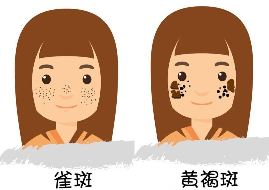 什么叫做黄褐斑，怎样去除黄褐斑偏方？