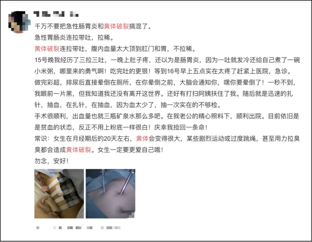 性生活不是“打架”，不少女孩都体会过“黄体破裂”的滋味