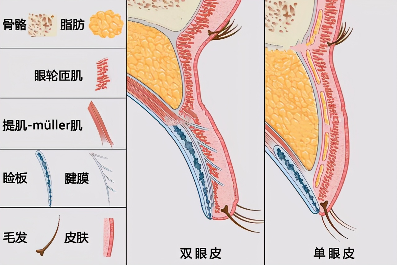 使用双眼皮贴可以贴出来双眼皮是真的吗？
