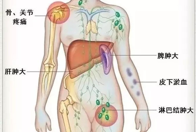 左侧腹部疼，是哪些病造成的？去医院做什么检查？医生告诉你