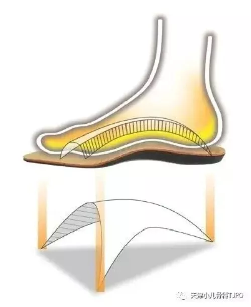 骨科大夫提醒您关于孩子足外翻，父母要知道的事情