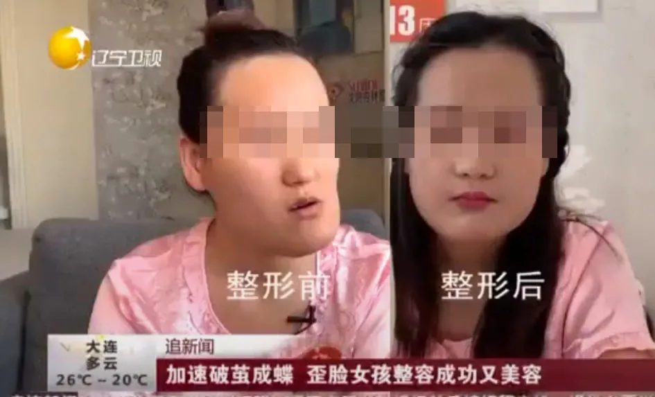 因“脸歪”难圆教师梦,术后逆袭变女神:感觉以后人生都不一样了