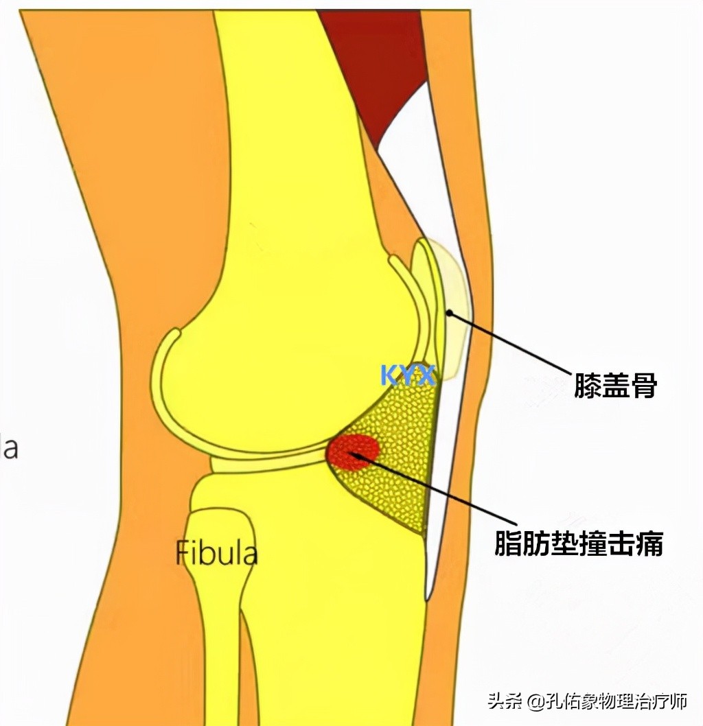 膝关节疼痛是怎么回事？常见的6个部位、8大病因，不可忽视