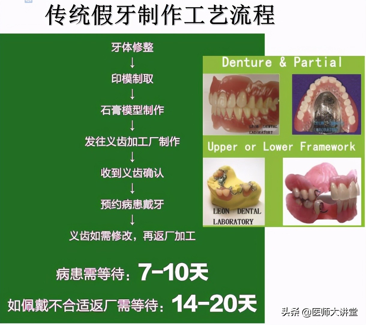 《假牙制作新方法》数字化创新镶牙代替传统镶牙时代来临了