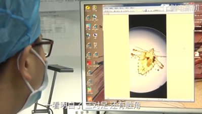 为什么现在还有人得阴虱？3种传播途径是“根源”，很多人中招