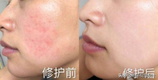 海藻面膜怎么调怎么用（图解）？敏感肌肤可以敷海藻面膜吗？