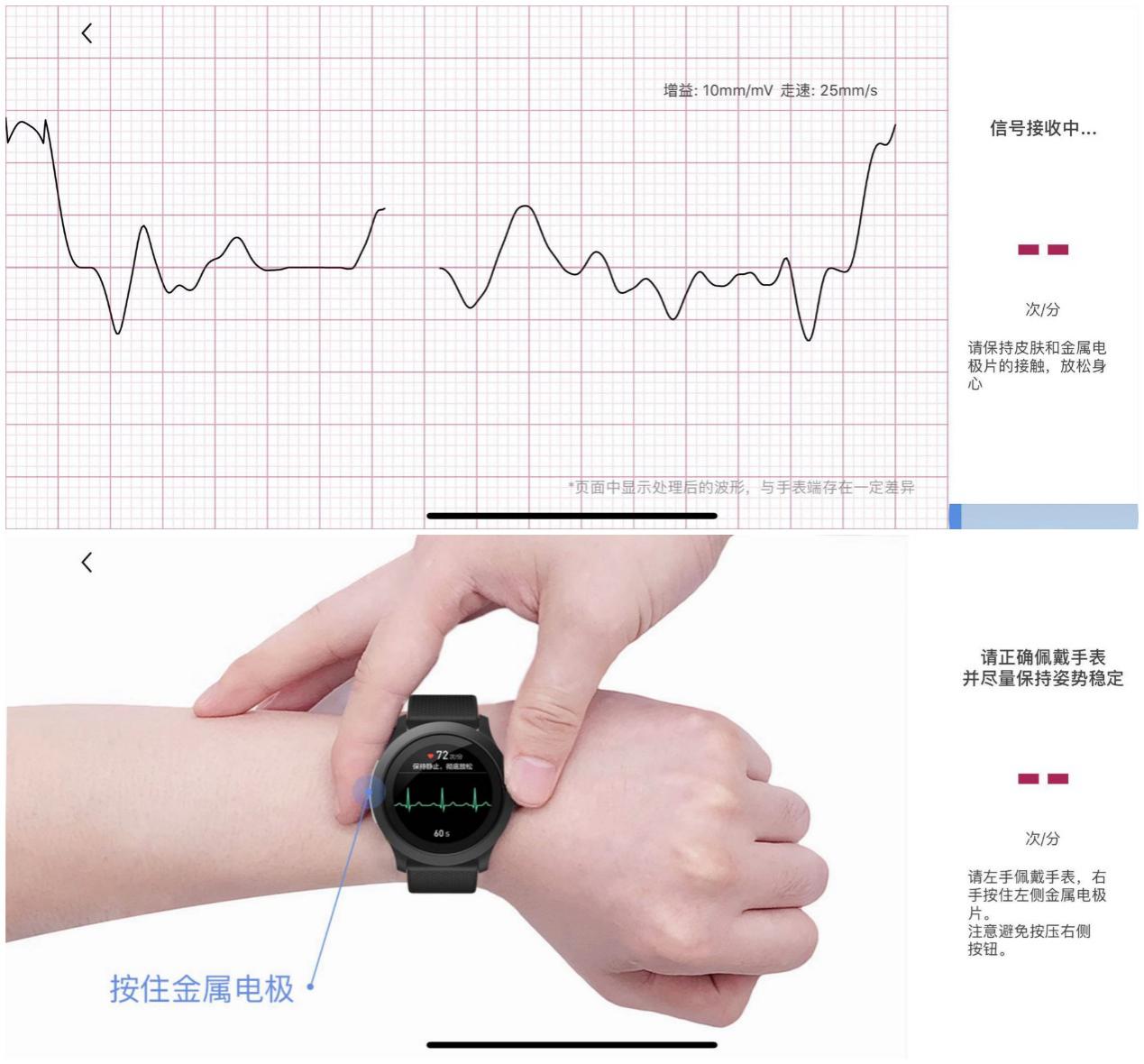 医学认可的测心率手表（性价比最高的医疗级健康手表）