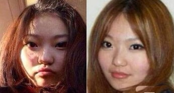 都说整容是娱乐圈“大忌”，而这10位明星，却因整容走向人生巅峰