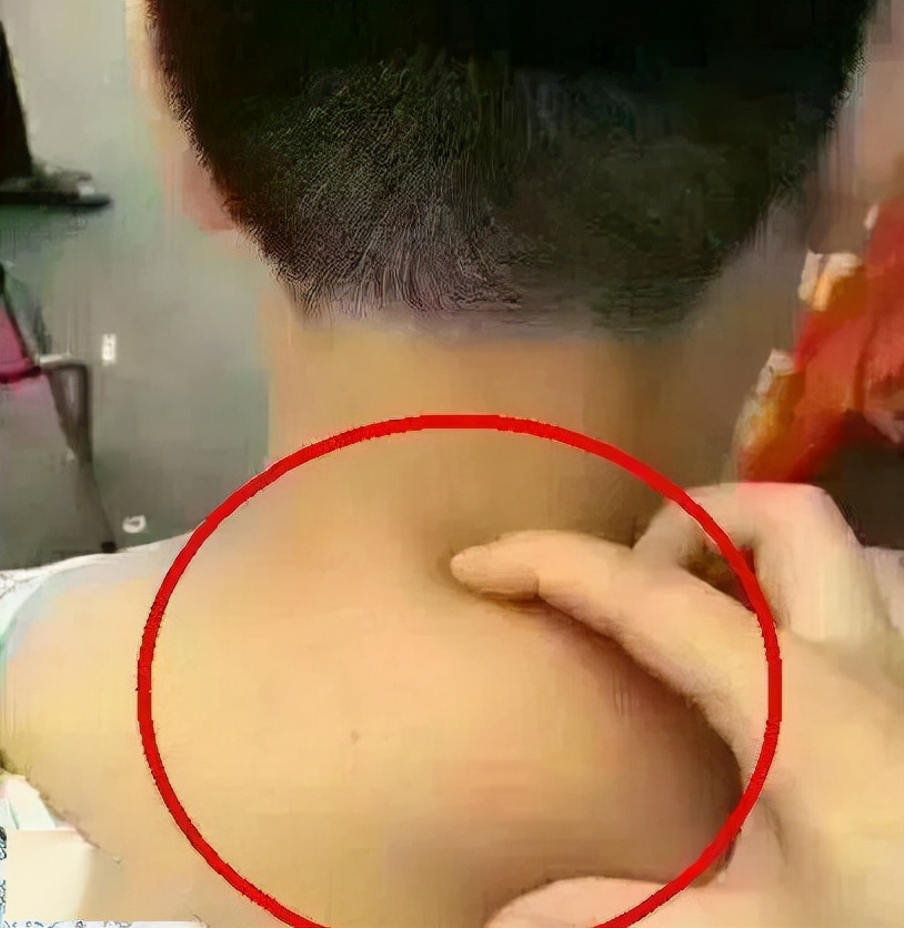 三大因素，导致体内湿气过重，身体3个地方鼓起来了，要当心