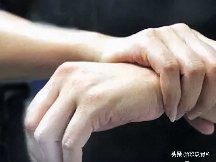 手指长骨刺图片(健康科普) - 赤虎壹号