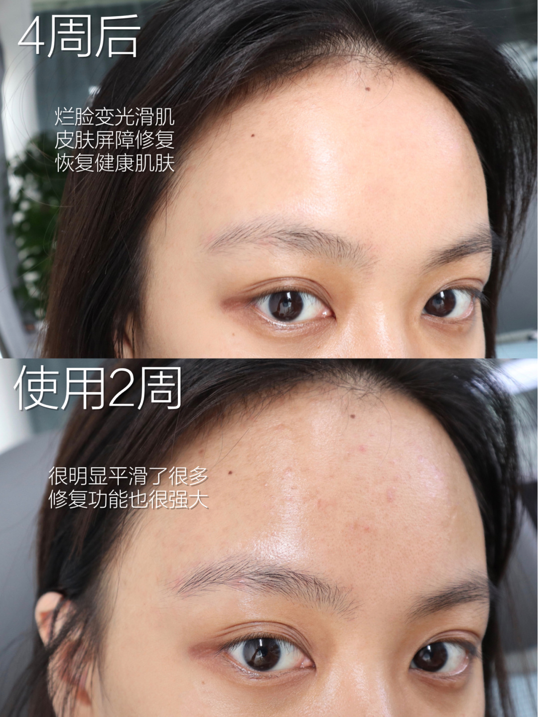 还过儿童节呢？25岁就开始“抗初老”了！这4款别说你一个没用过