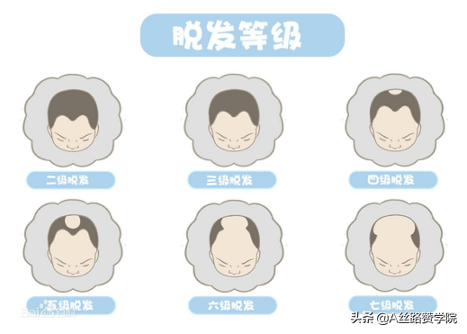“头等大事”！浅谈医药行业-植发子赛道市场