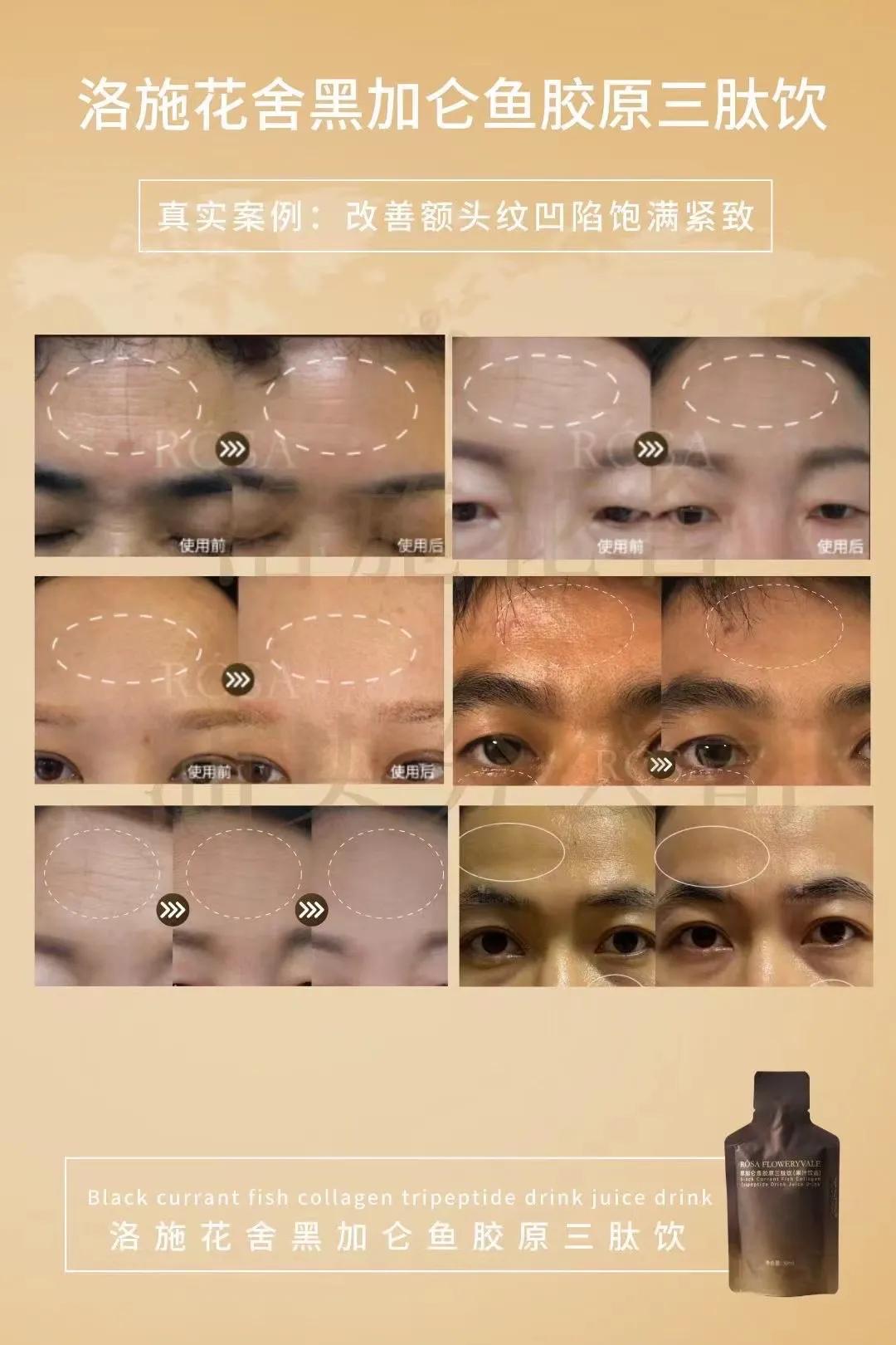 洛施花舍黑加仑抗衰饮效果怎么样？多少钱？