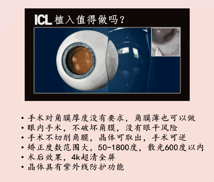 哪些方法可以让你实现摘镜愿望？