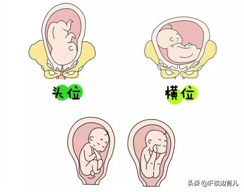 剖腹产以后再怀孕能自然分娩吗？