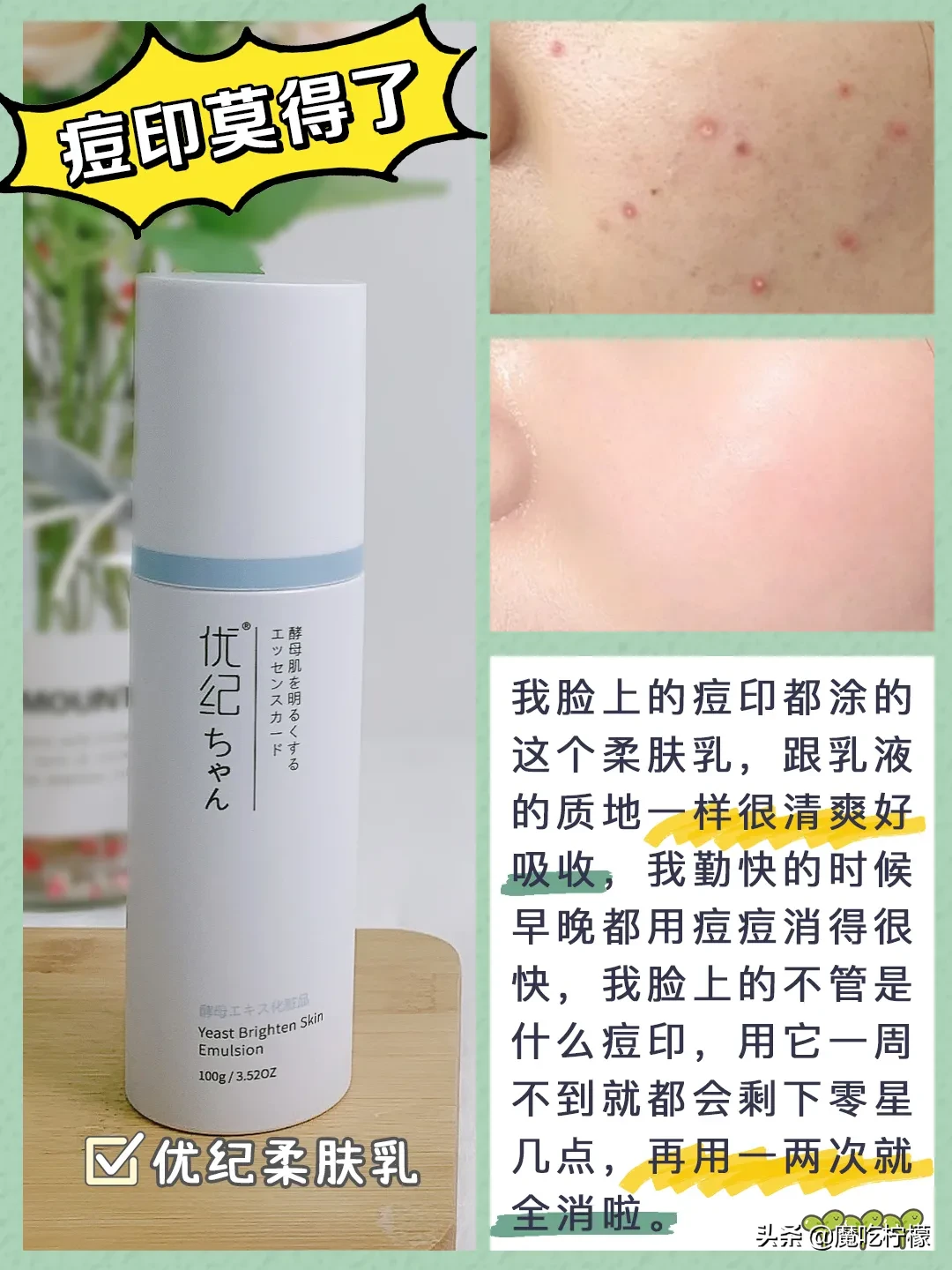 关于皮肤问题我感觉真的我最有发言权了，一天天的不是长闭口就是长痘痘