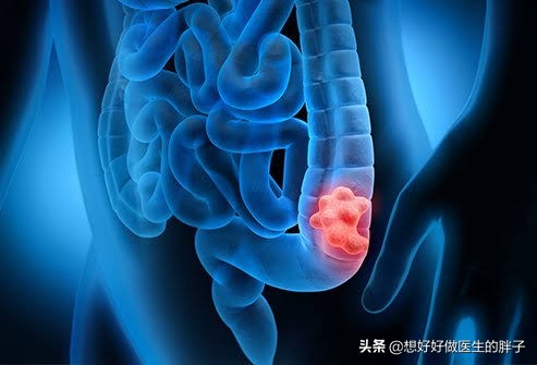诱发左侧腹痛的常见病因有哪些，啥检查能初步判断下？医生告诉您