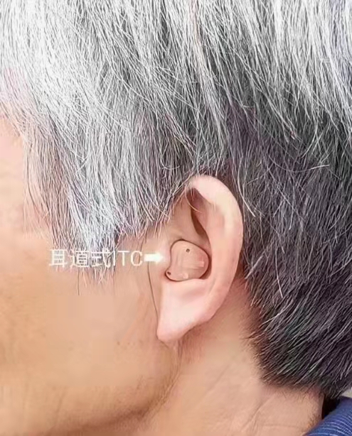 随着社会的不断进步，噪音在我们生活中也是无处不在，导致很多人出现耳鸣现象