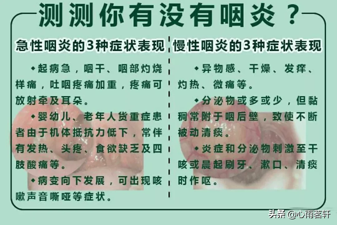 慢性咽炎吃什么药最好(<慢性咽炎你选对药了吗？>)
