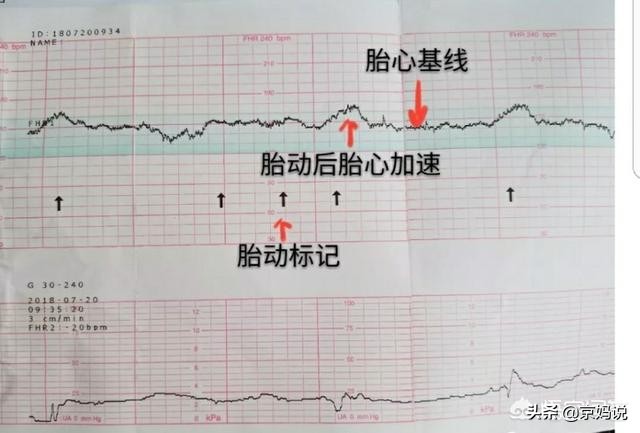 孕妇产检哪些是必须检查的项目？