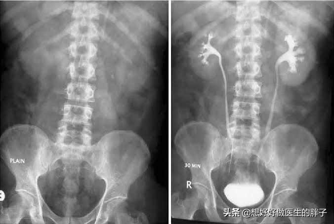 诱发左侧腹痛的常见病因有哪些，啥检查能初步判断下？医生告诉您