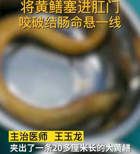 泰州兴化某医院接诊了一名特殊的患者:该男子来时面色苍白，疼痛难忍
