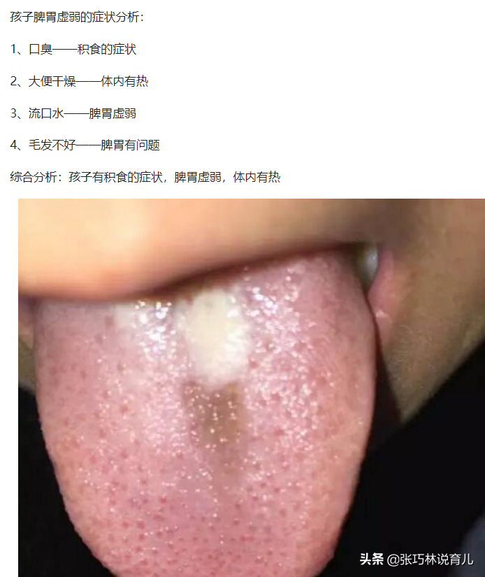 小孩口臭的原因和治疗方法，是脾胃虚弱吗？