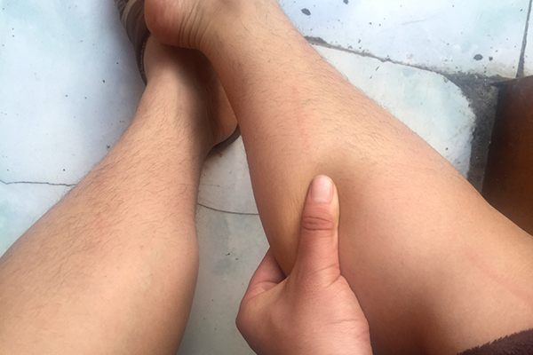 身体是否有病，看腿可先知，腿上有3个表现，不可大意，尽早检查