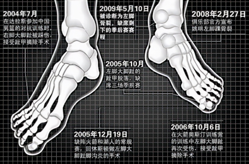 为什么nba球员没有白头(看了詹姆斯脚趾、马龙白发、罗斯膝盖，你还羡慕NBA球星高薪吗？)