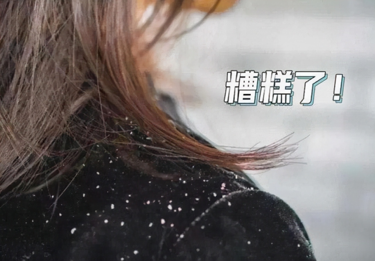 坚持用“醋”洗头，一段时间会有何变化？4大变化或“不请自来”