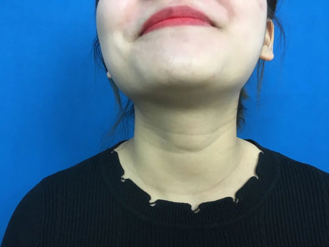 为什么寿命不长的人，身体会有这“3粗”，尽早发现，或可长寿